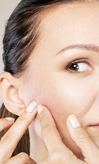 4 common skin problems and ways to deal with them